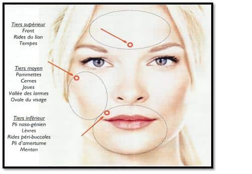 Chirurgie esthétique contre le vieillissement du visage