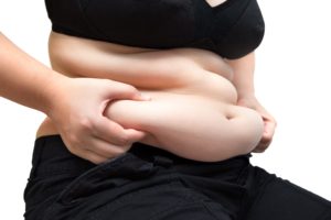 Plastie abdominale de réduction du gros ventre